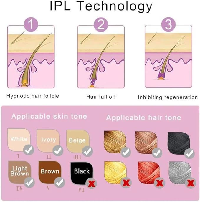 Laser Permanent Hair Removal Machine